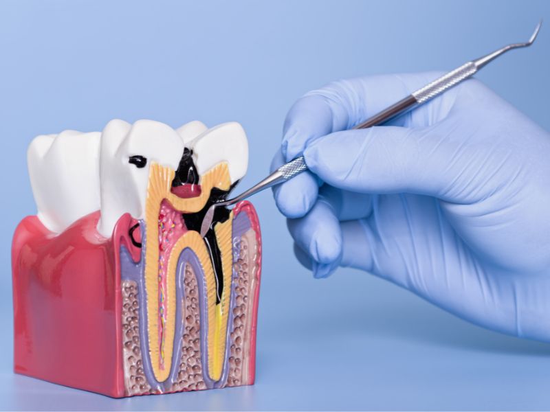 técnicas avanzadas en periodoncia