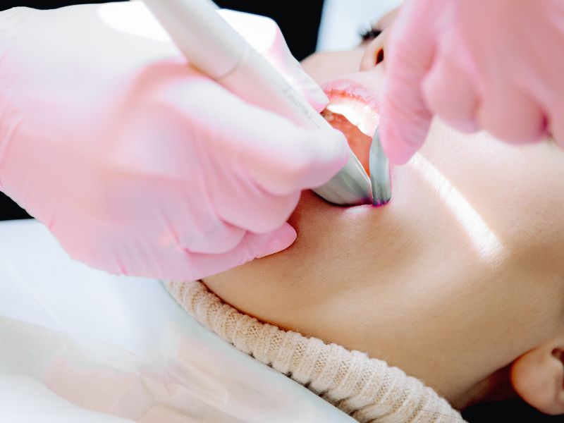 certificación en tartrectomía para higienistas